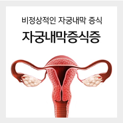 비정상적인 자궁내막 증식 자궁내막증식증
